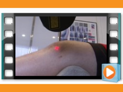 MLS Laser Therapy Results